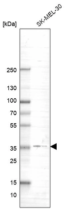 Western blot analysis in human cell line SK-MEL-30.