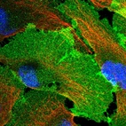 Immunofluorescent staining of human cell line U-2 OS shows localization to plasma membrane.