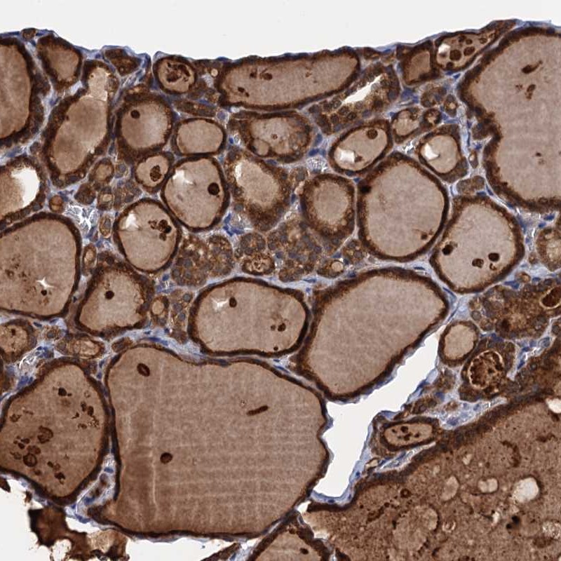 Anti-PGLS Antibody