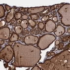 Anti-PGLS Antibody