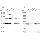 Western blot analysis using Anti-PGLS antibody HPA040744 (A) shows similar pattern to independent antibody HPA042032 (B).