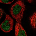 Immunofluorescent staining of human cell line A-431 shows localization to nucleoplasm.