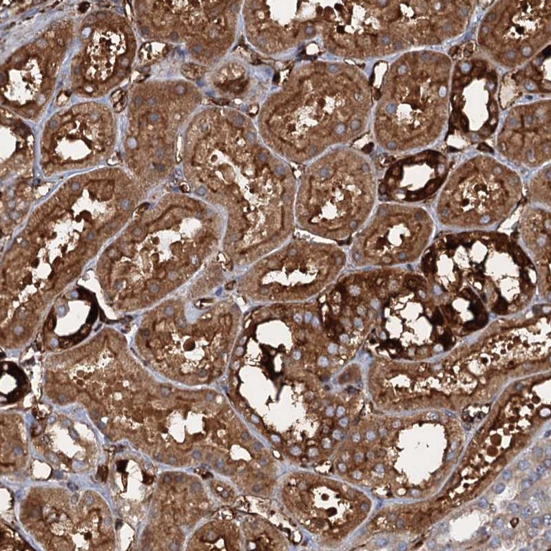 Anti-CCDC81 Antibody