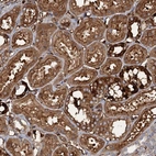 Anti-CCDC81 Antibody