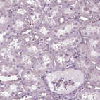 Immunohistochemical staining of human kidney shows no cytoplasmic positivity in cells in tubules.
