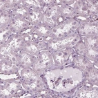 Immunohistochemical staining of human kidney shows no cytoplasmic positivity in cells in tubules.