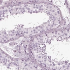 Immunohistochemical staining of human testis shows no positivity in cells in seminiferous ducts.