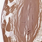 Immunohistochemical staining of human eye shows moderate cytoplasmic positivity in lens fiber cells.