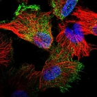 Immunofluorescent staining of human cell line U-251 MG shows localization to plasma membrane & cytosol.