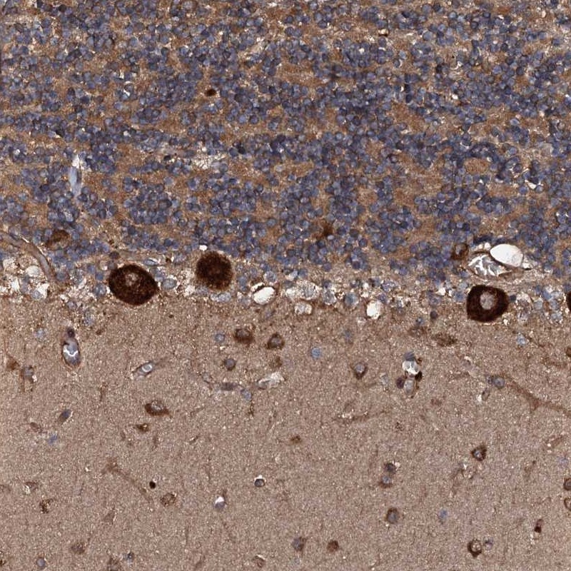 Anti-FLYWCH1 Antibody