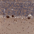 Anti-FLYWCH1 Antibody