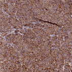 Anti-HERPUD1 Antibody