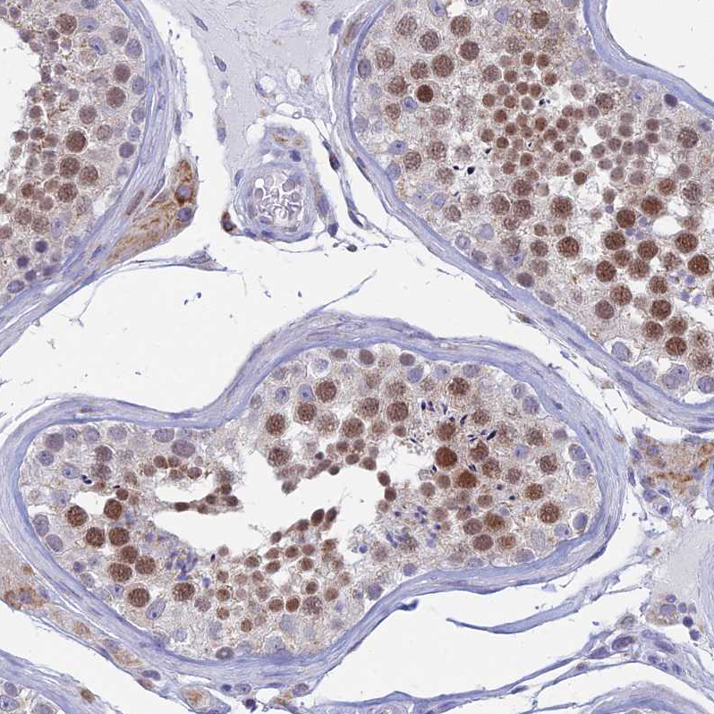 Anti-AC004381.6 Antibody
