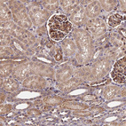 Immunohistochemical staining of human kidney shows strong cytoplasm granular positivity in cells in glomeruli.
