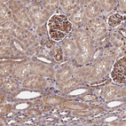 Anti-HERPUD1 Antibody