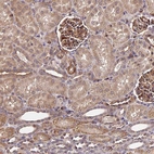 Immunohistochemical staining of human kidney shows strong cytoplasm granular positivity in cells in glomeruli.