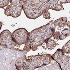 Anti-HERPUD1 Antibody