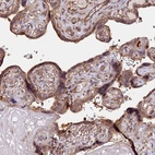 Immunohistochemical staining of human placenta shows moderate cytoplasm granular positivity in trophoblastic cells.