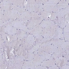 Immunohistochemical staining of human skeletal muscle shows no positivity in myocytes as expected.