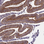 Immunohistochemical staining of human endometrium shows strong cytoplasm granular positivity in glandular cells.