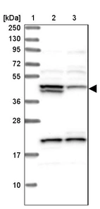 Lane 1: Marker [kDa] 250, 130, 95, 72, 55, 36, 28, 17, 10_br/_Lane 2: Human cell line RT-4_br/_Lane 3: Human cell line U-251MG sp