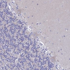 Immunohistochemical staining of human cerebellum shows no positivity in Purkinje cells as expected.