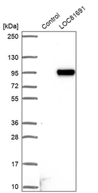 Western blot analysis in control (vector only transfected HEK293T lysate) and LOC81691 over-expression lysate (Co-expressed with a C-terminal myc-DDK tag (~3.1 kDa) in mammalian HEK293T cells, LY403099).