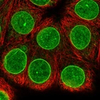 Immunofluorescent staining of human cell line MCF7 shows localization to nucleoli & nuclear membrane.