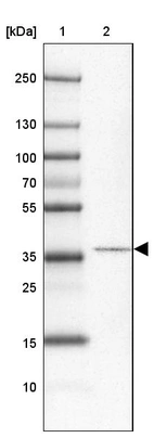 Lane 1: Marker [kDa] 250, 130, 100, 70, 55, 35, 25, 15, 10_br/_Lane 2: Human Testis tissue