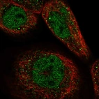 Immunofluorescent staining of human cell line A-431 shows localization to nucleoplasm & cytosol.