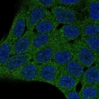 Anti-PHLPP2 Antibody