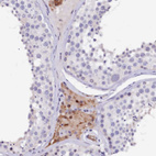 Anti-CTDSPL2 Antibody