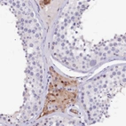Anti-CTDSPL2 Antibody