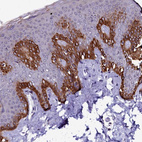 Immunohistochemical staining of human skin shows strong membranous/cytoplasmic positivity in squamous epithelial cells.