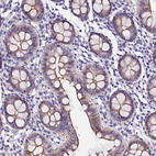 Immunohistochemical staining of human colon shows moderate membranous/cytoplasmic positivity in glandular cells.