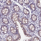 Immunohistochemical staining of human colon shows moderate membranous/cytoplasmic positivity in glandular cells.