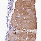 Immunohistochemical staining of human skeletal muscle shows moderate cytoplasmic positivity in myocytes.