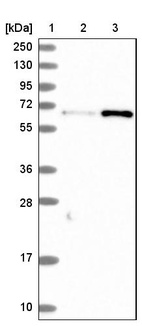 Lane 1: Marker [kDa] 250, 130, 95, 72, 55, 36, 28, 17, 10_br/_Lane 2: Human cell line RT-4_br/_Lane 3: Human cell line U-251MG sp