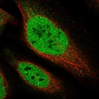 Immunofluorescent staining of human cell line U-2 OS shows localization to nucleoplasm.