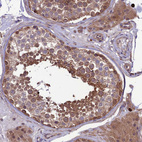 Immunohistochemical staining of human testis shows moderate cytoplasmic positivity in cells in seminiferous ducts.
