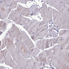 Immunohistochemical staining of human skeletal muscle shows very weak cytoplasmic positivity in myocytes.