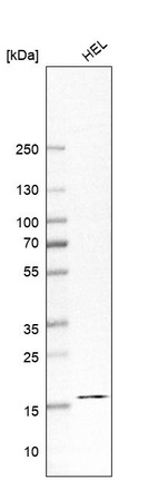 Western blot analysis in human cell line HEL.