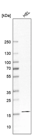 Western blot analysis in human cell line HEL.