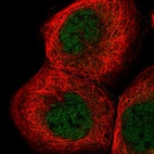 Immunofluorescent staining of human cell line A-431 shows localization to nucleoplasm.