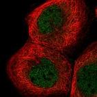 Immunofluorescent staining of human cell line A-431 shows localization to nucleoplasm.