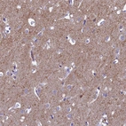 Immunohistochemical staining of human cerebral cortex shows moderate positivity in neuropil.