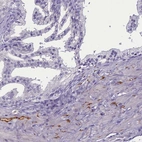 Immunohistochemical staining of human prostate shows moderate cytoplasmic positivity in peripheral nerve.