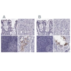 Immunohistochemical staining of human colon, liver, lymph node and testis using Anti-FAM71B antibody HPA040771 (A) shows similar protein distribution across tissues to independent antibody HPA039478 (B).
