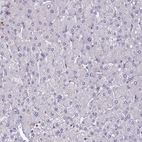 Immunohistochemical staining of human liver shows no positivity in hepatocytes as expected.