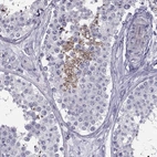 Immunohistochemical staining of human testis shows high expression.